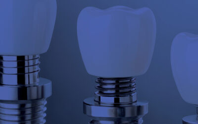 Soluciones para la Industria Dental
