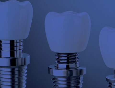 Soluciones para la Industria Dental
